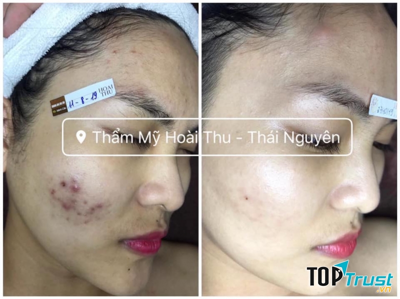 Thẩm Mỹ Hoài Thu