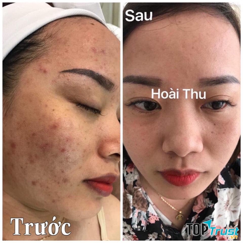 Thẩm Mỹ Hoài Thu