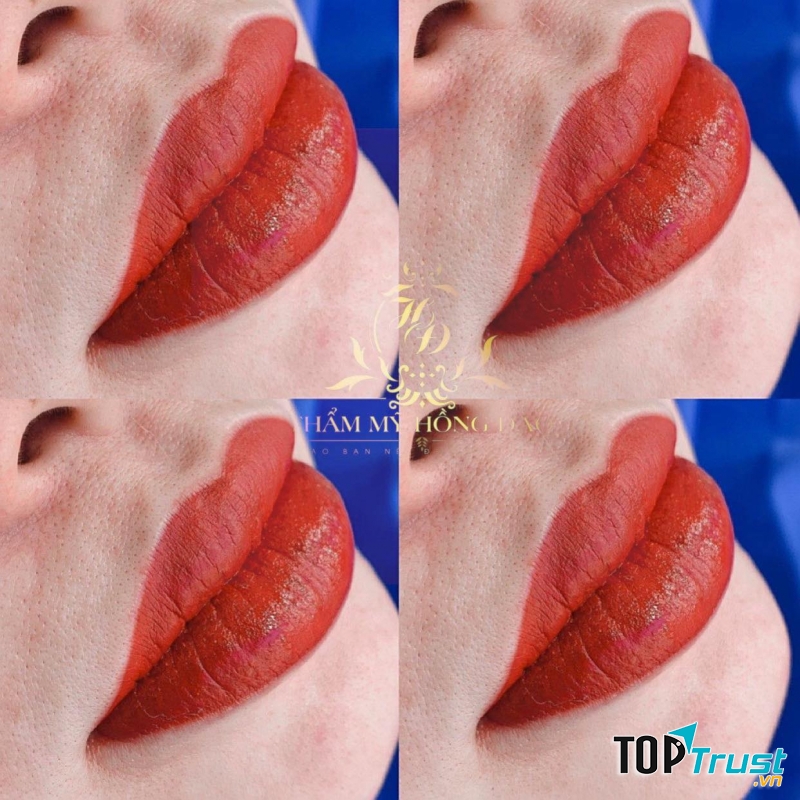 Thẩm Mỹ Hồng Đào