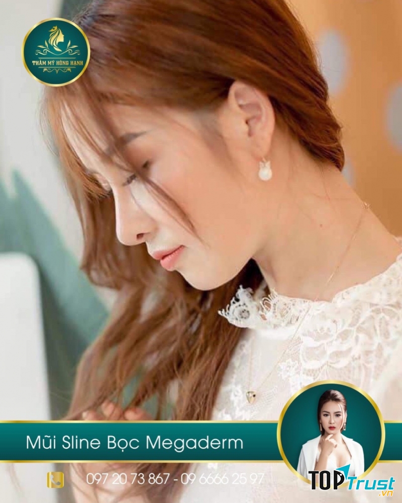 Thẩm mỹ Hồng Hạnh