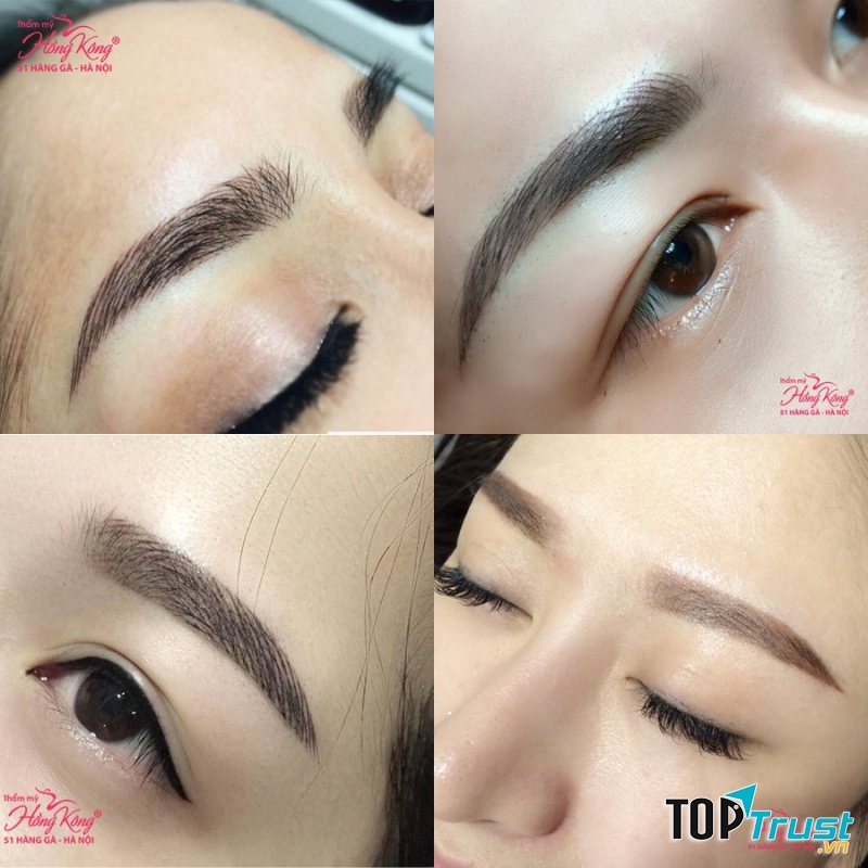Thẩm mỹ Hồng Kông