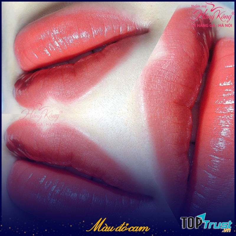 Thẩm mỹ Hồng Kông