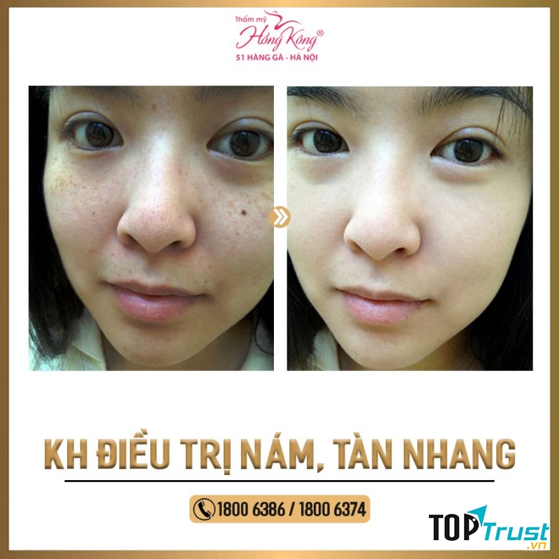 Thẩm mỹ Hồng Kông
