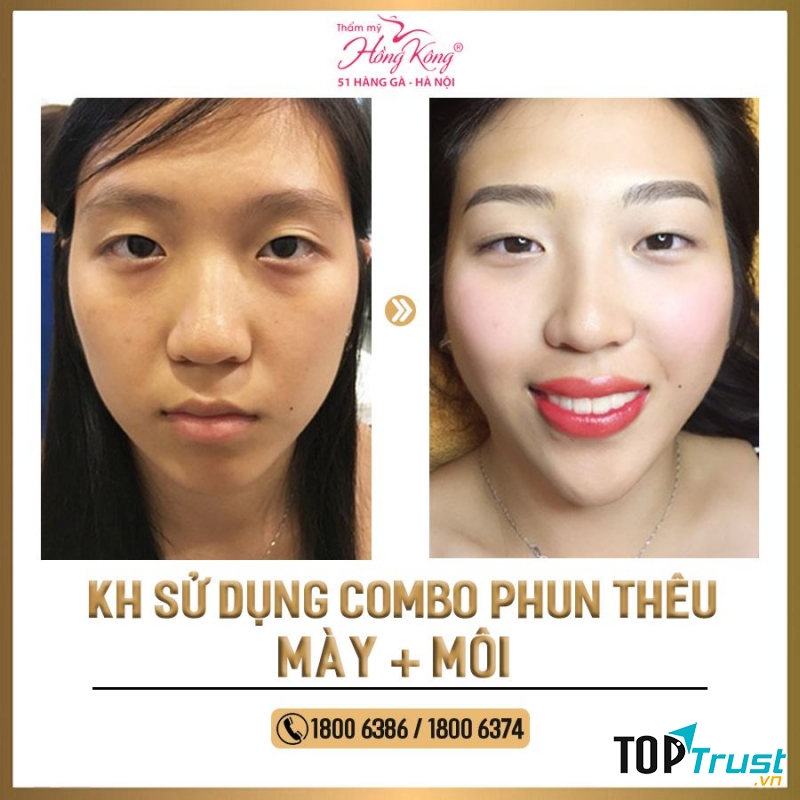 Thẩm mỹ Hồng Kông