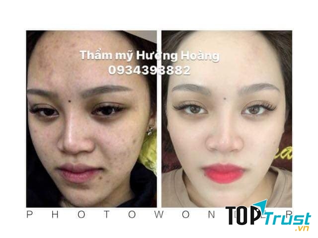 Thẩm mỹ Hường Hoàng