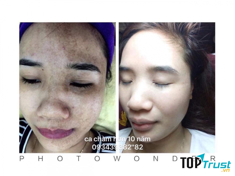 Thẩm mỹ Hường Hoàng