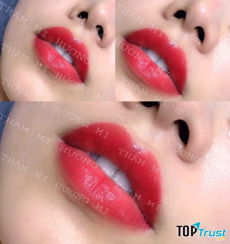 Thẩm Mỹ Viện Hương Mi