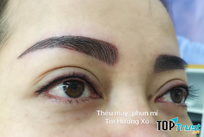 THẨM MỸ HƯỜNG XÔ