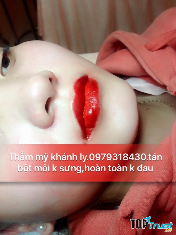 Thẩm Mỹ Khánh Ly