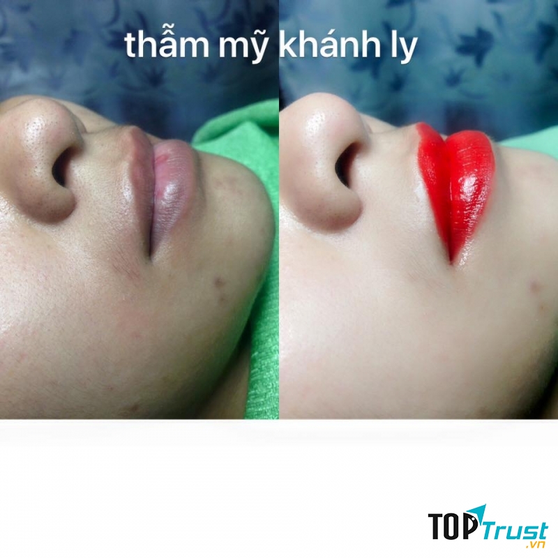 Thẩm Mỹ Khánh Ly