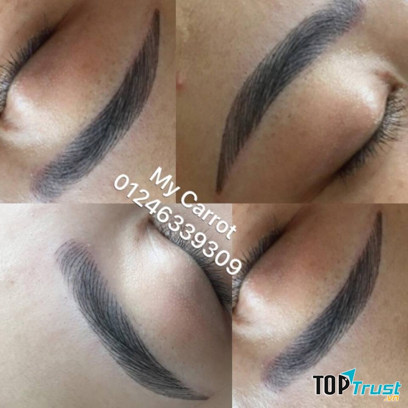 Thẩm Mỹ Khánh My