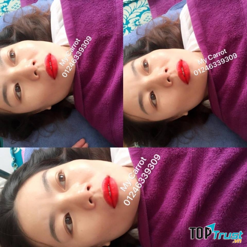 Thẩm Mỹ Khánh My