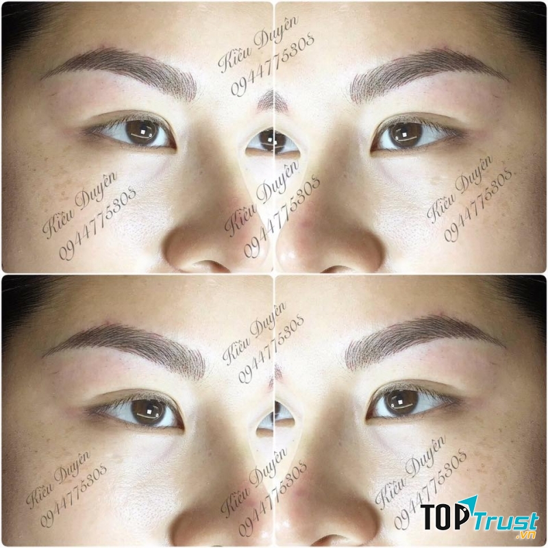 Thẩm mỹ Kiều Duyên