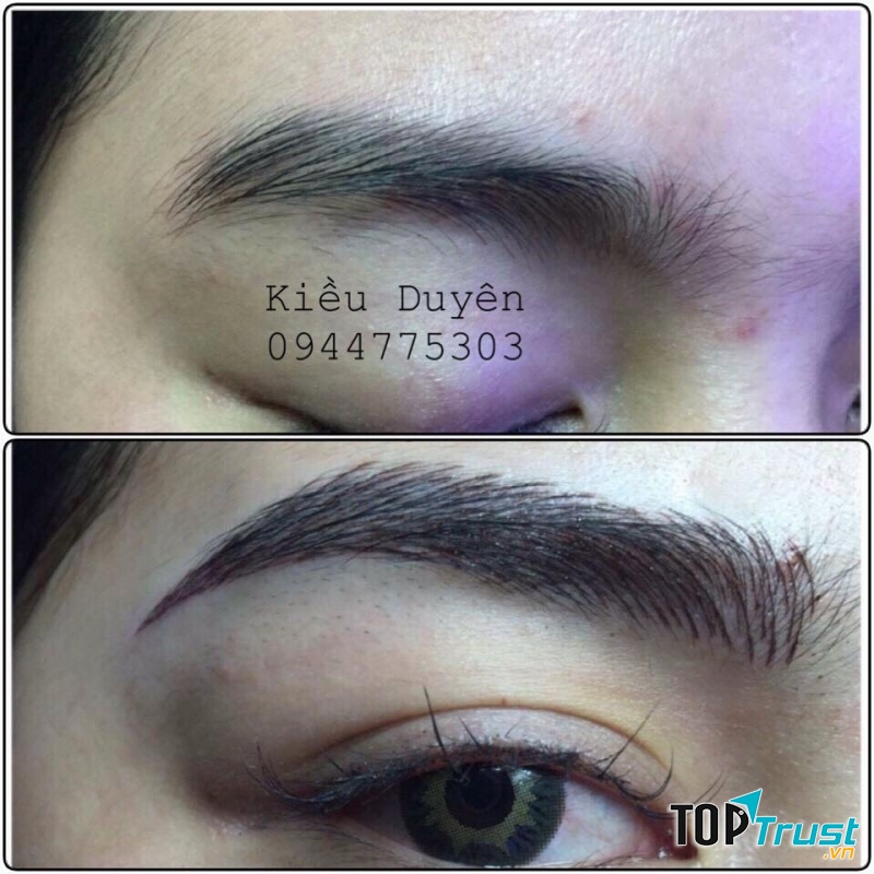 Thẩm mỹ Kiều Duyên