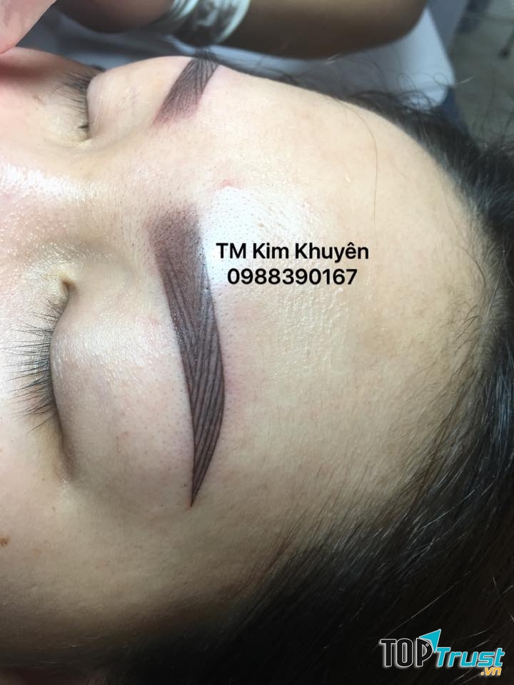 Thẩm mỹ Kim Khuyên