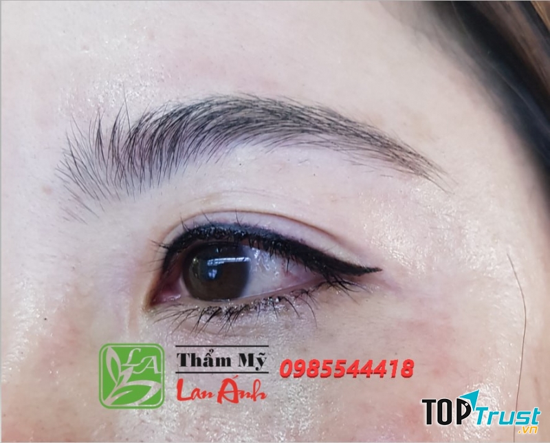 Thẩm Mỹ Lan Ánh