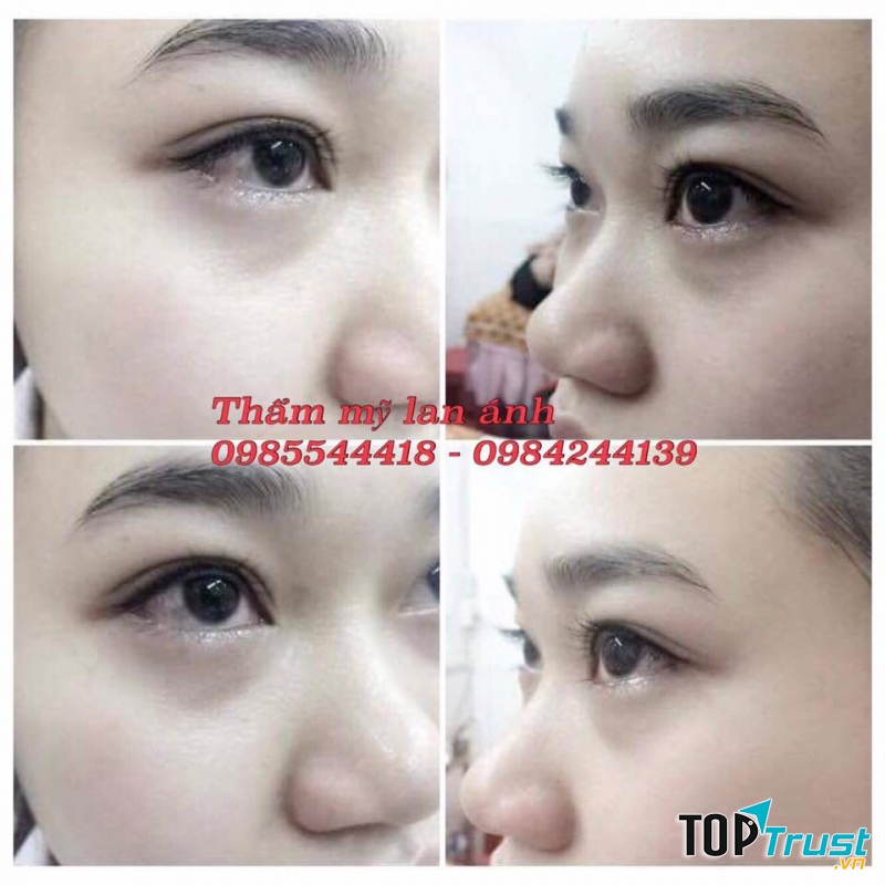 Thẩm Mỹ Lan Ánh