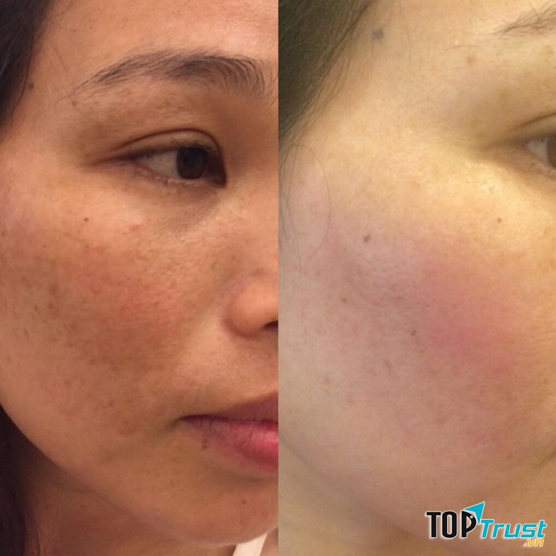 Thẩm Mỹ Lavenia Vinh