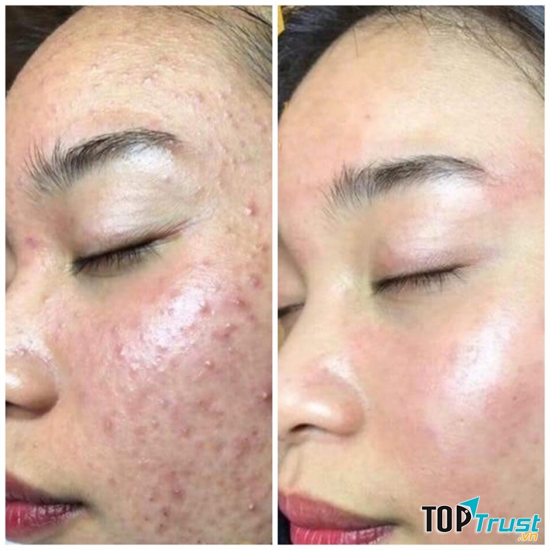 Thẩm mỹ Lily Ninh Bình