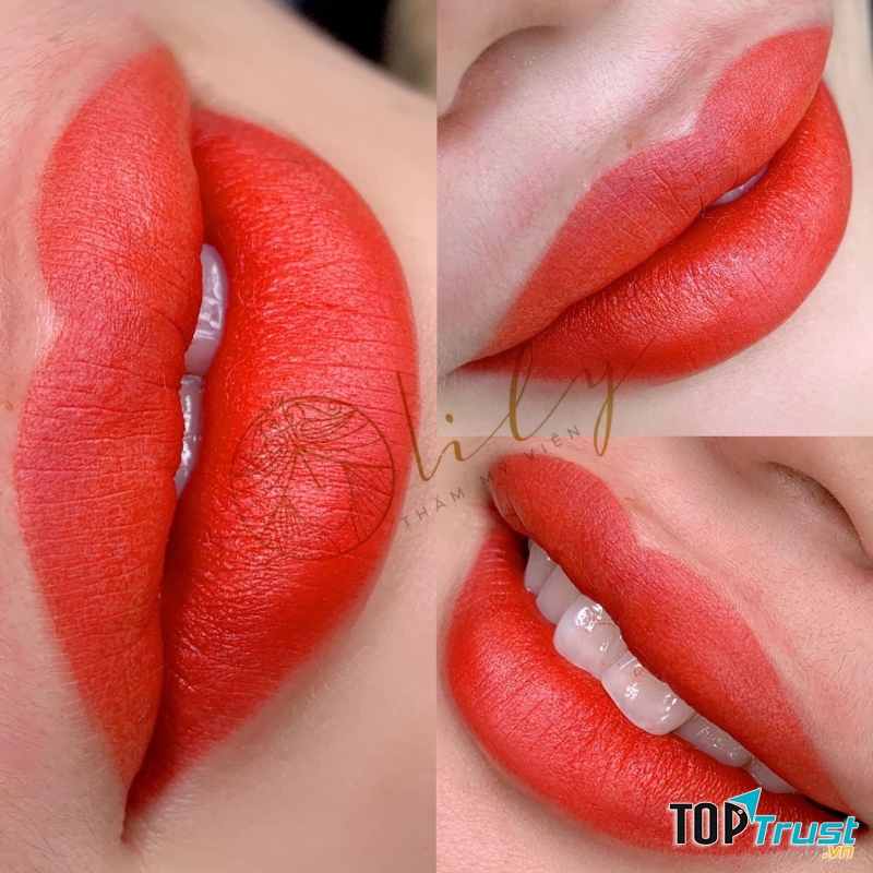 Thẩm mỹ Lily Ninh Bình