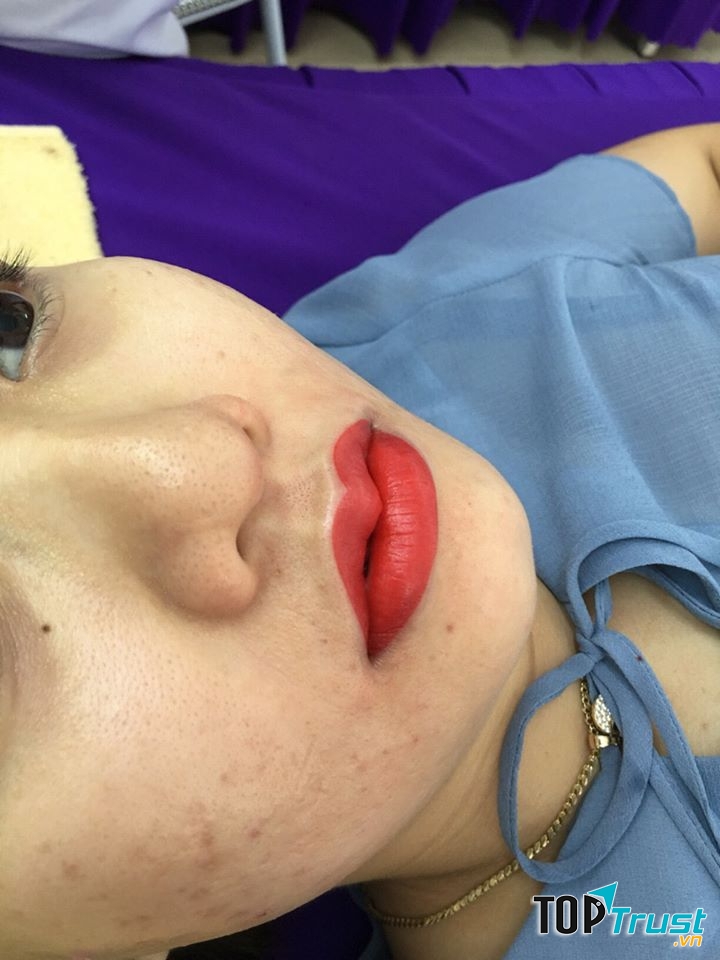 Thẩm mỹ Linh Anh