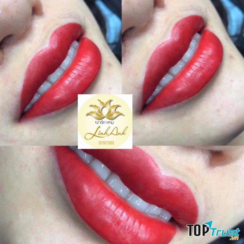 Thẩm mỹ Linh Anh