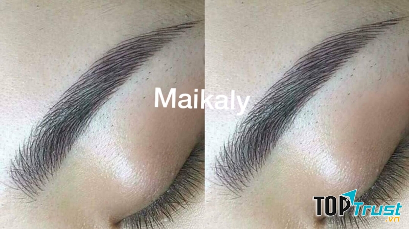 Thẩm mỹ Maika Ly