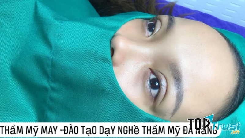 Thẩm mỹ May