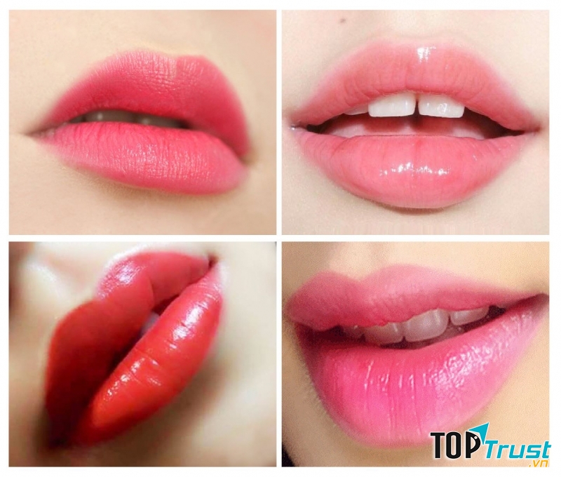 Phun môi tại thẩm mỹ Melia