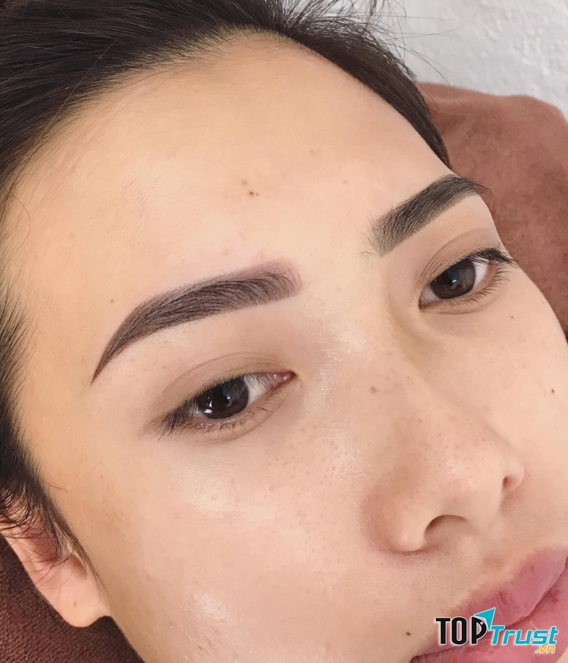 Thẩm mỹ Minh Cường Bắc Ninh