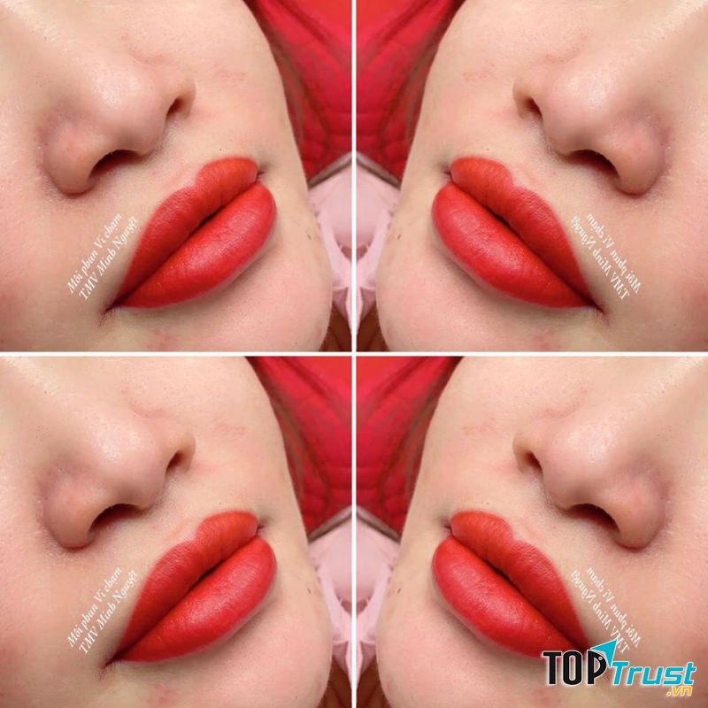 Thẩm Mỹ Minh Nguyệt