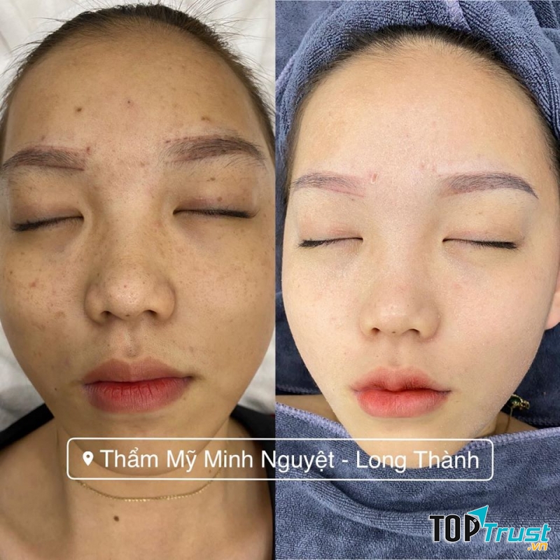 Thẩm Mỹ Minh Nguyệt