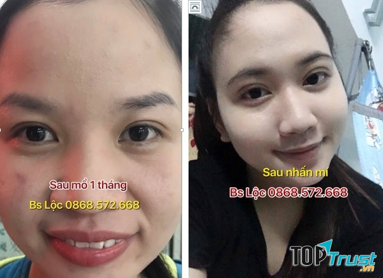 Thẩm mỹ Miss Duyên Quy Nhơn