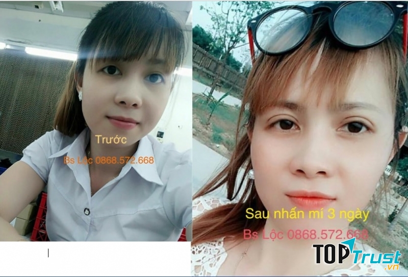 Thẩm mỹ Miss Duyên Quy Nhơn