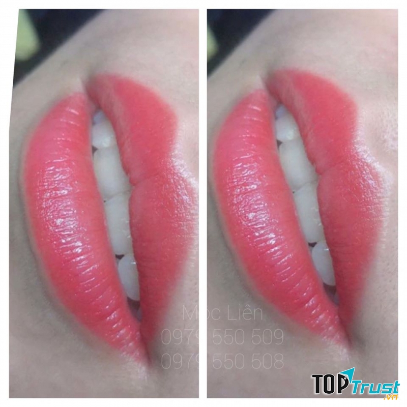 Thẩm Mỹ Mộc Liên