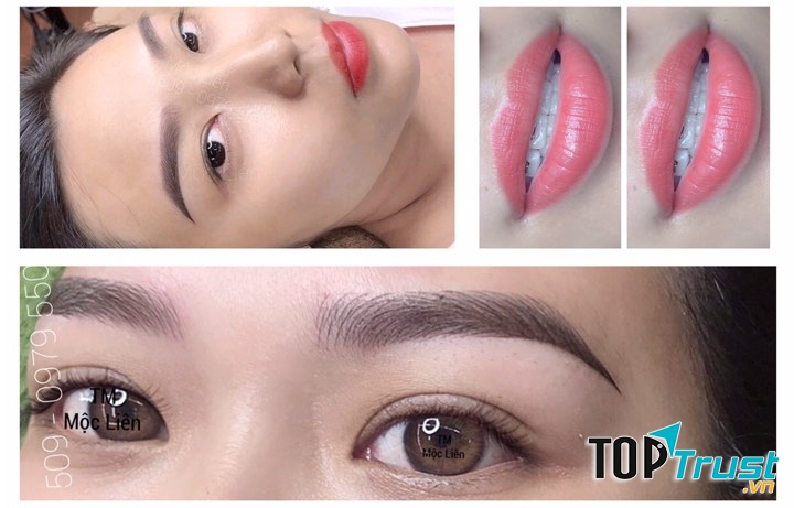 Thẩm Mỹ Mộc Liên