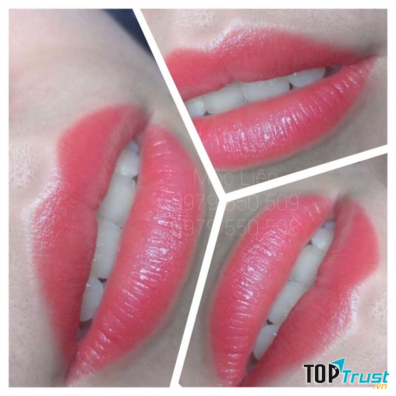 Thẩm Mỹ Mộc Liên