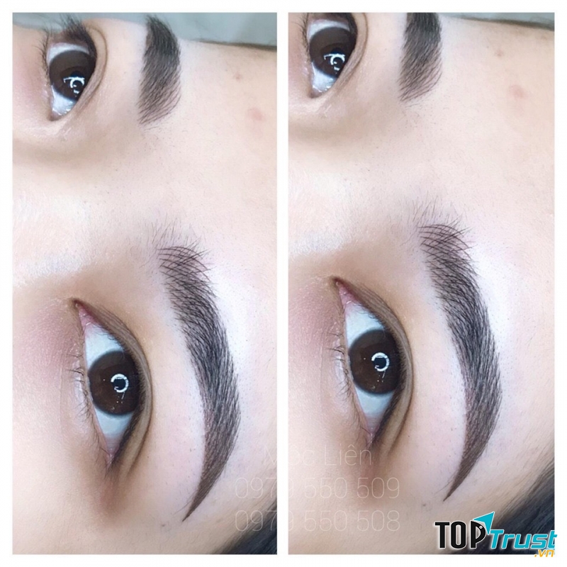 Thẩm Mỹ Mộc Liên