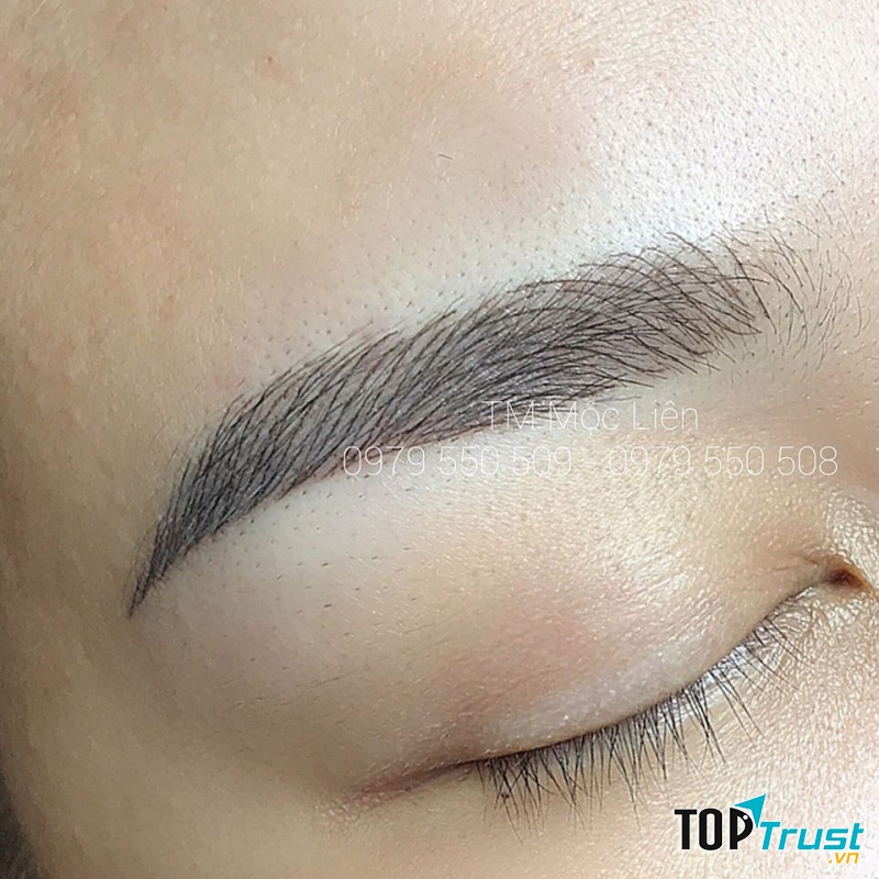 Thẩm Mỹ Mộc Liên