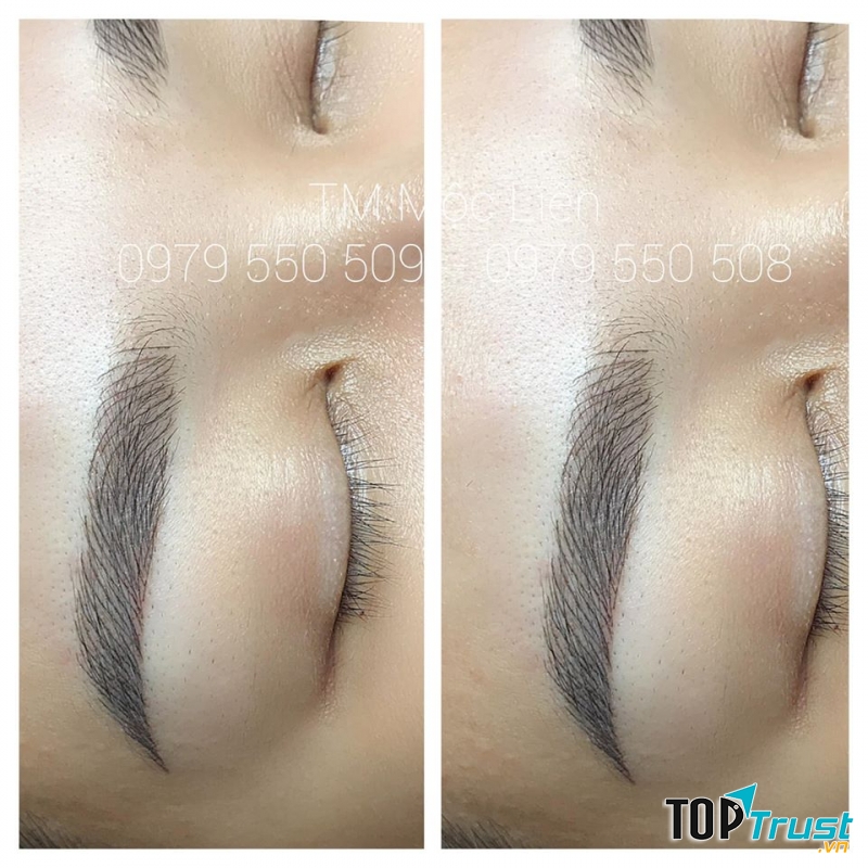 Thẩm Mỹ Mộc Liên