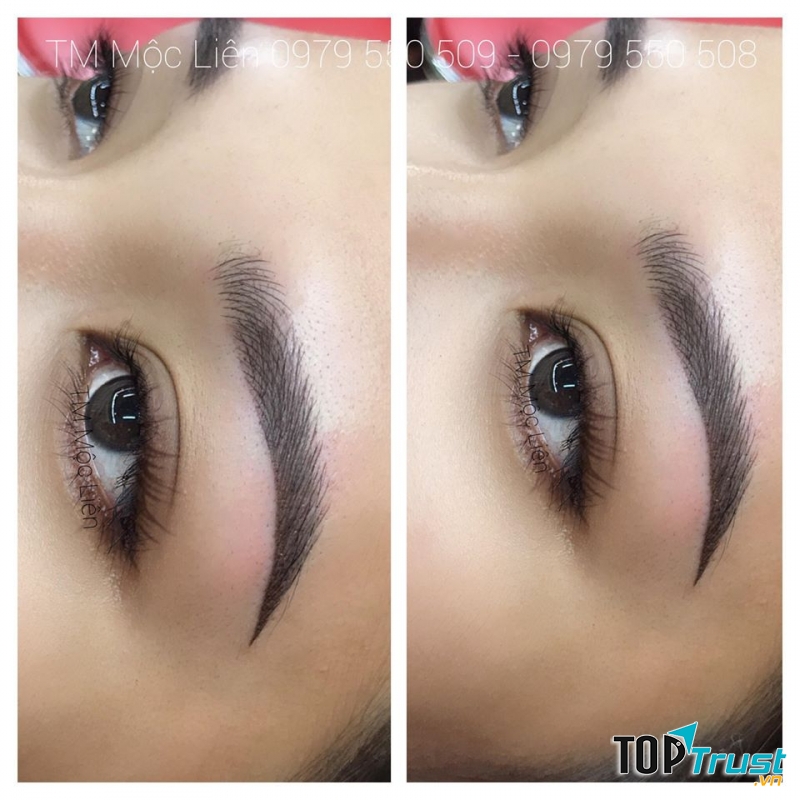 Thẩm Mỹ Mộc Liên