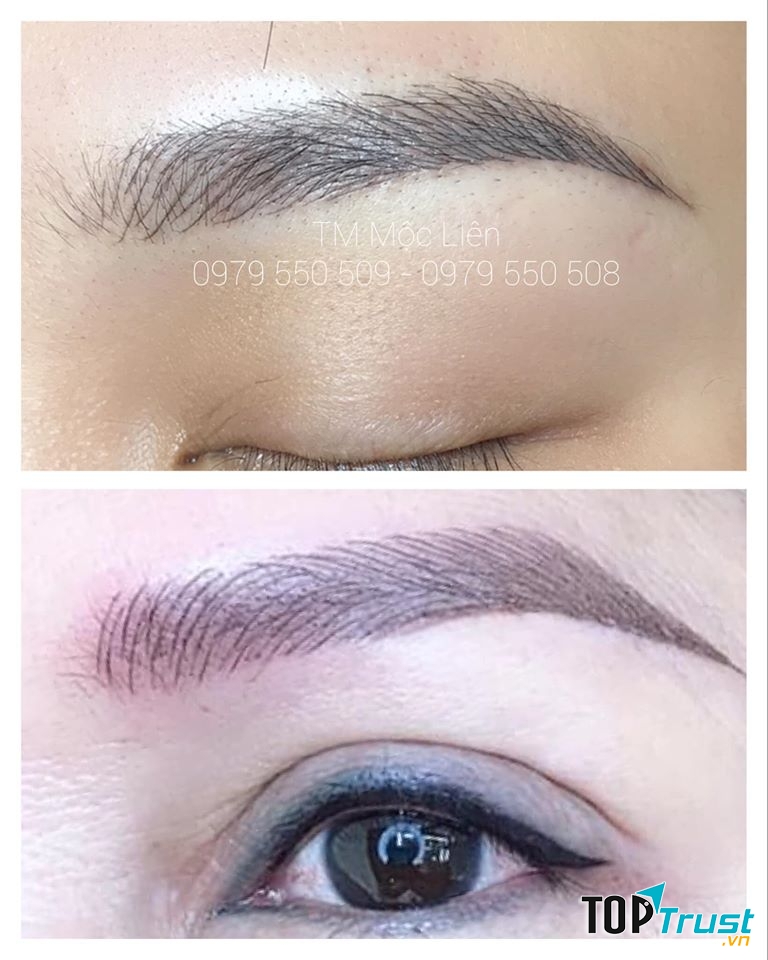 Thẩm Mỹ Mộc Liên