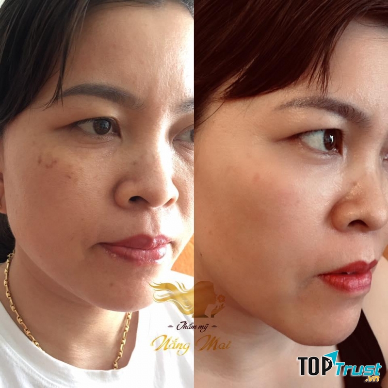 Thẩm Mỹ Nắng Mai - Spa Quận 9