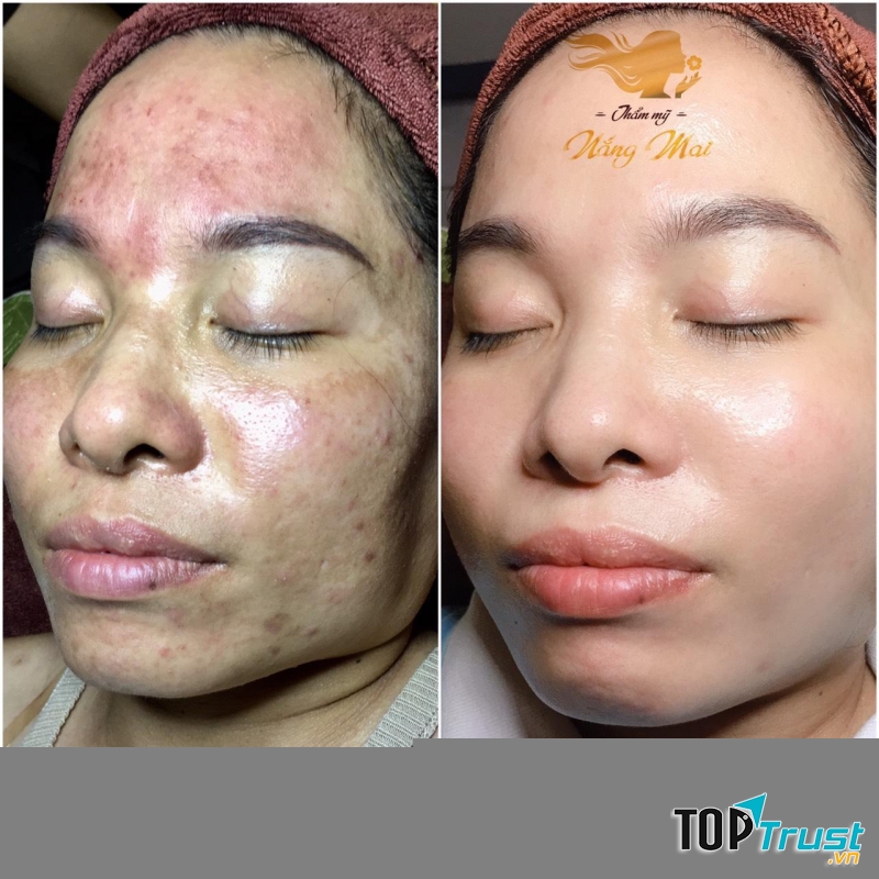 Thẩm Mỹ Nắng Mai - Spa Quận 9