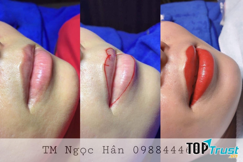 Thẩm Mỹ Ngọc Hân TiKi beauty