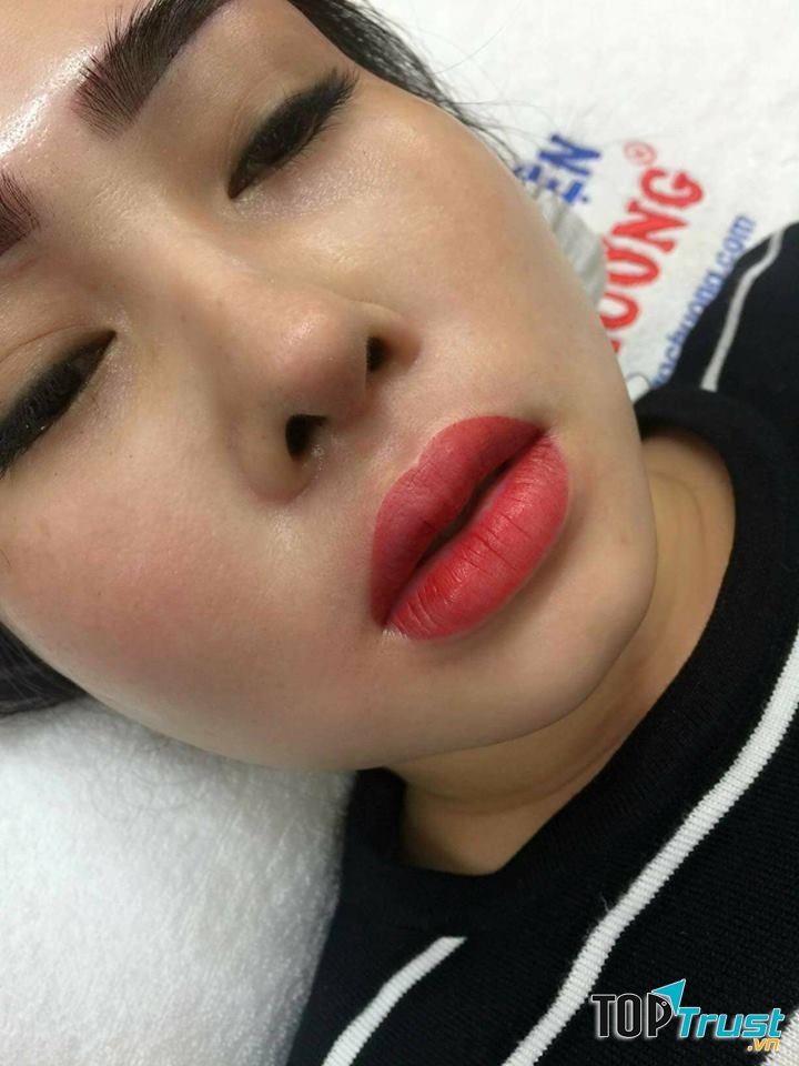 Thẩm mỹ Ngọc Hường