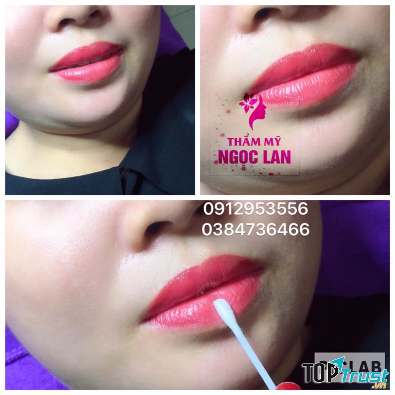 Thẩm Mỹ Ngọc Lan