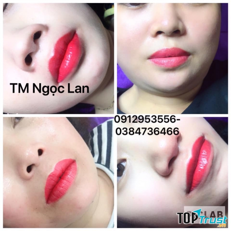 Thẩm Mỹ Ngọc Lan