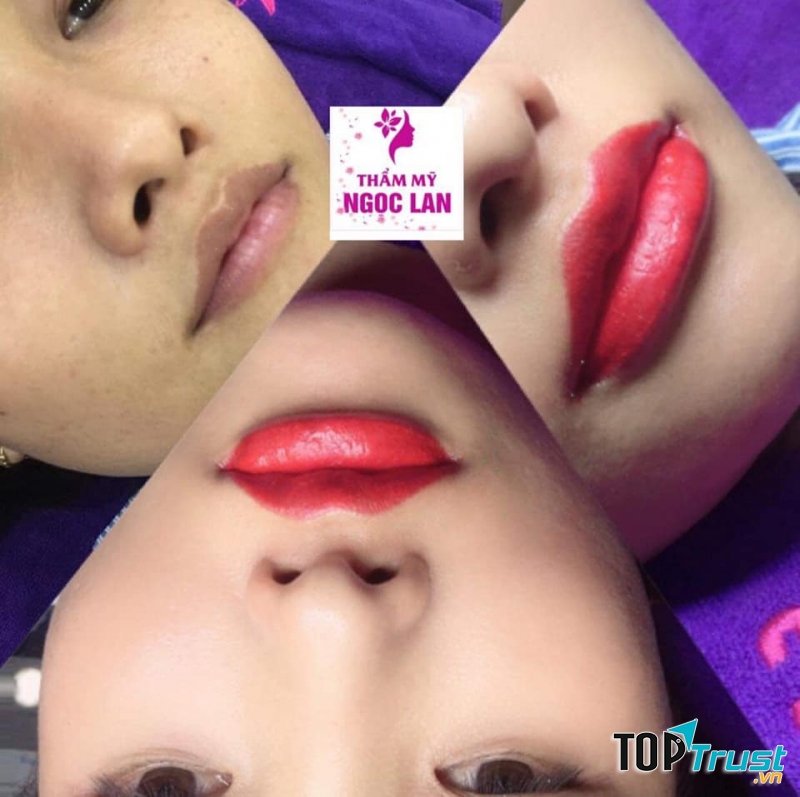 Thẩm Mỹ Ngọc Lan