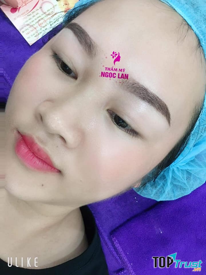 Thẩm Mỹ Ngọc Lan